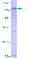 12.5% SDS-PAGE Stained with Coomassie Blue.